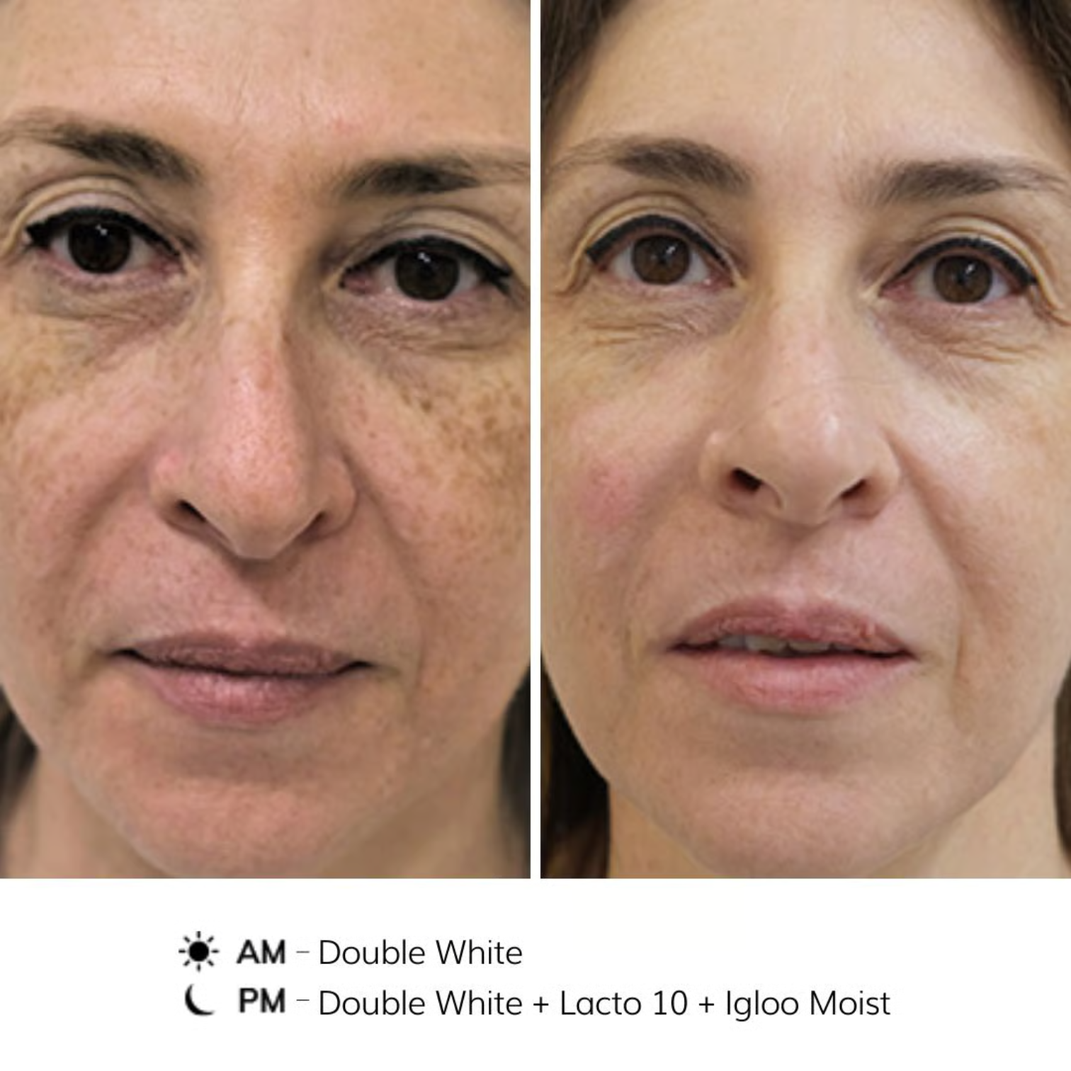NOON Double White | Clinical Brightening Dual-Phase Treatment