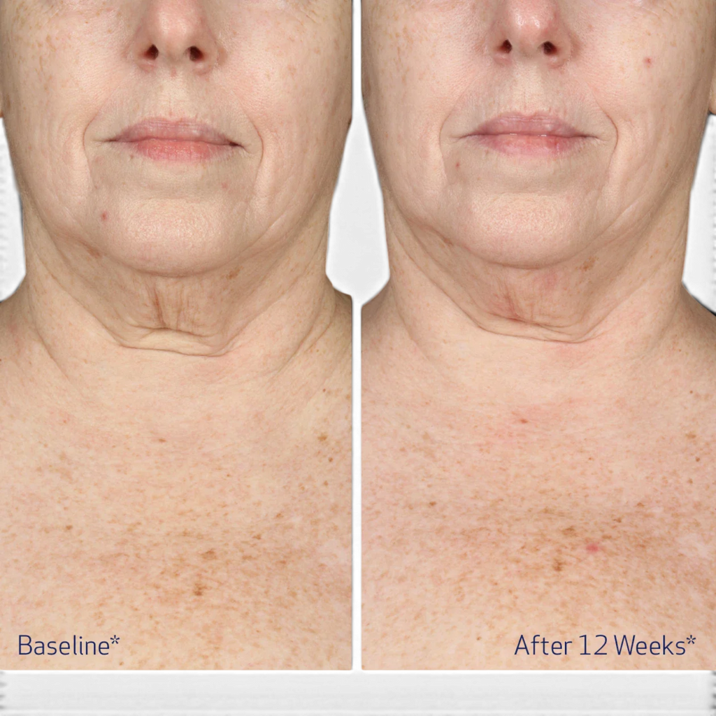 Obagi Elastiderm® Neck and Décolleté Concentrate