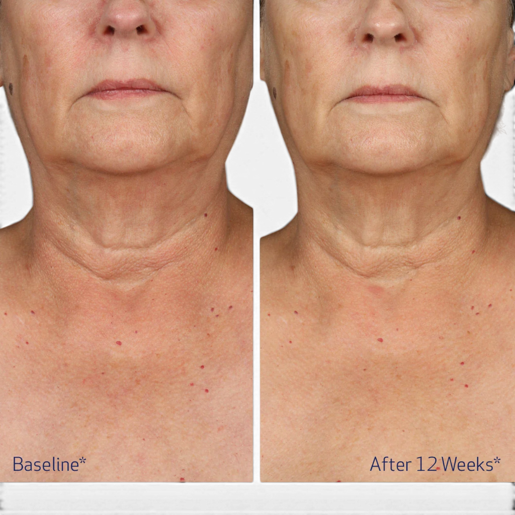 Obagi Elastiderm® Neck and Décolleté Concentrate