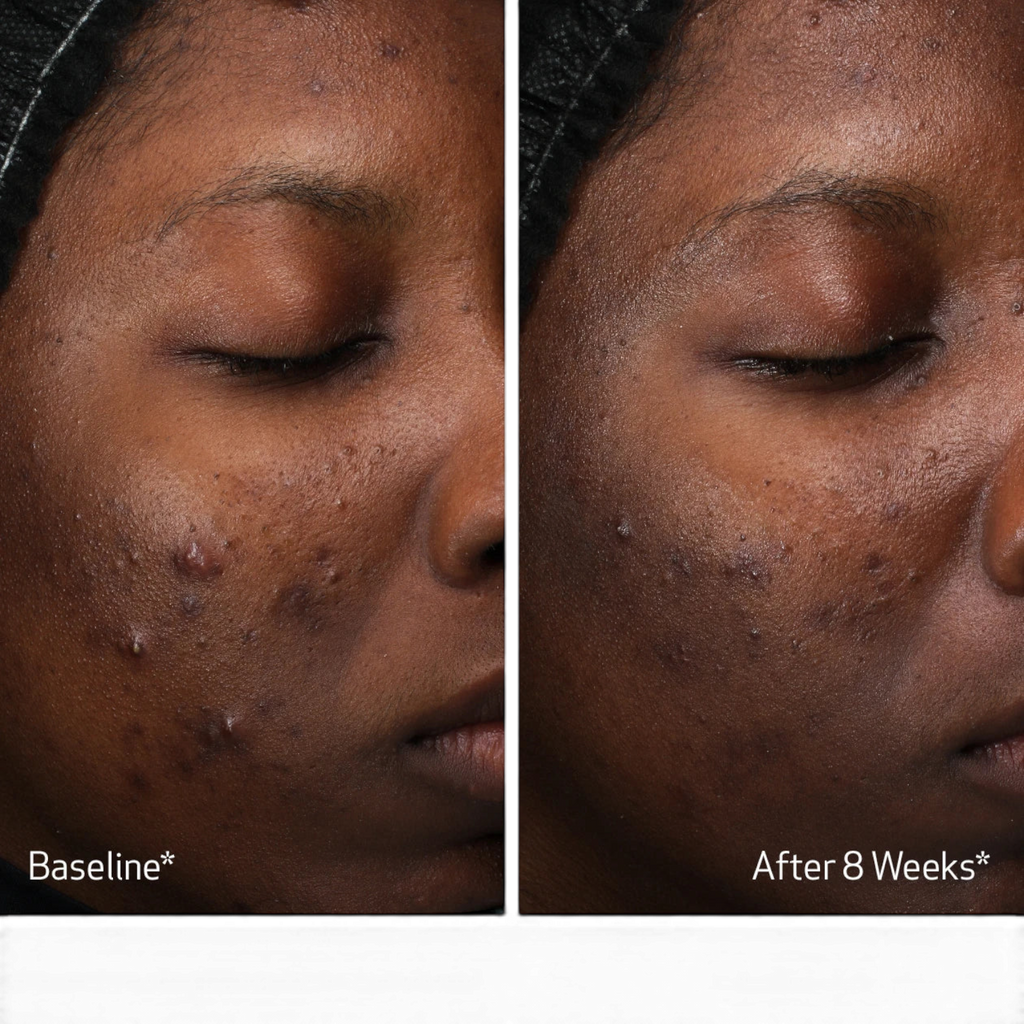 Obagi Retinol + PHA Refining Night Cream