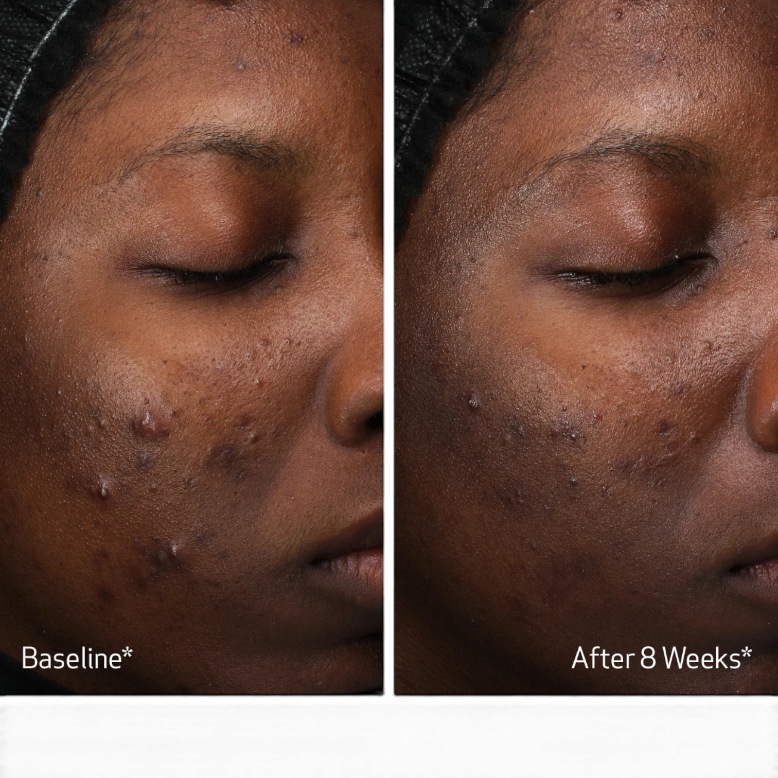 Obagi Retinol + PHA Refining Night Cream
