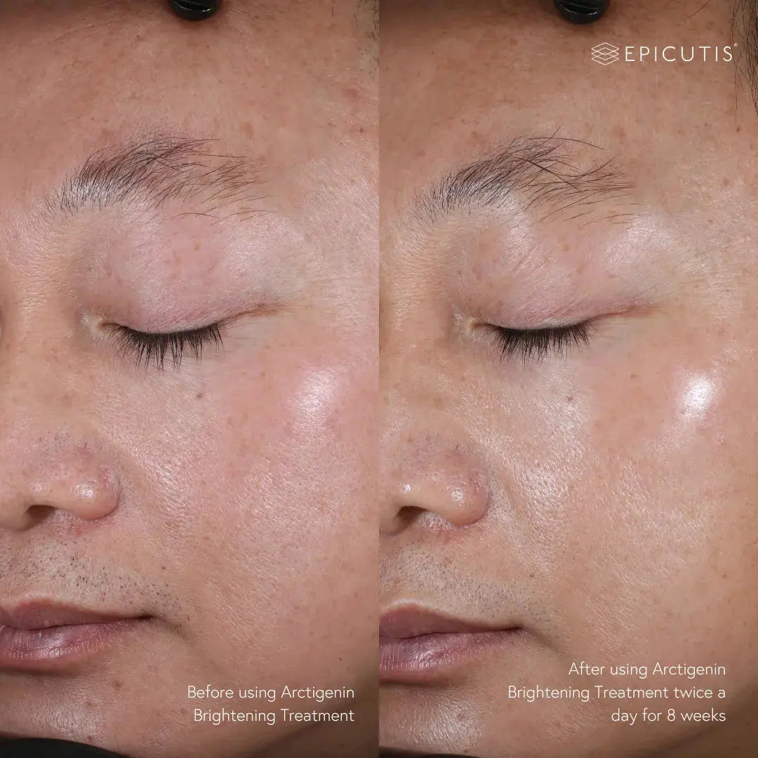 Epicutis Arctigenin Brightening Treatment 30ml