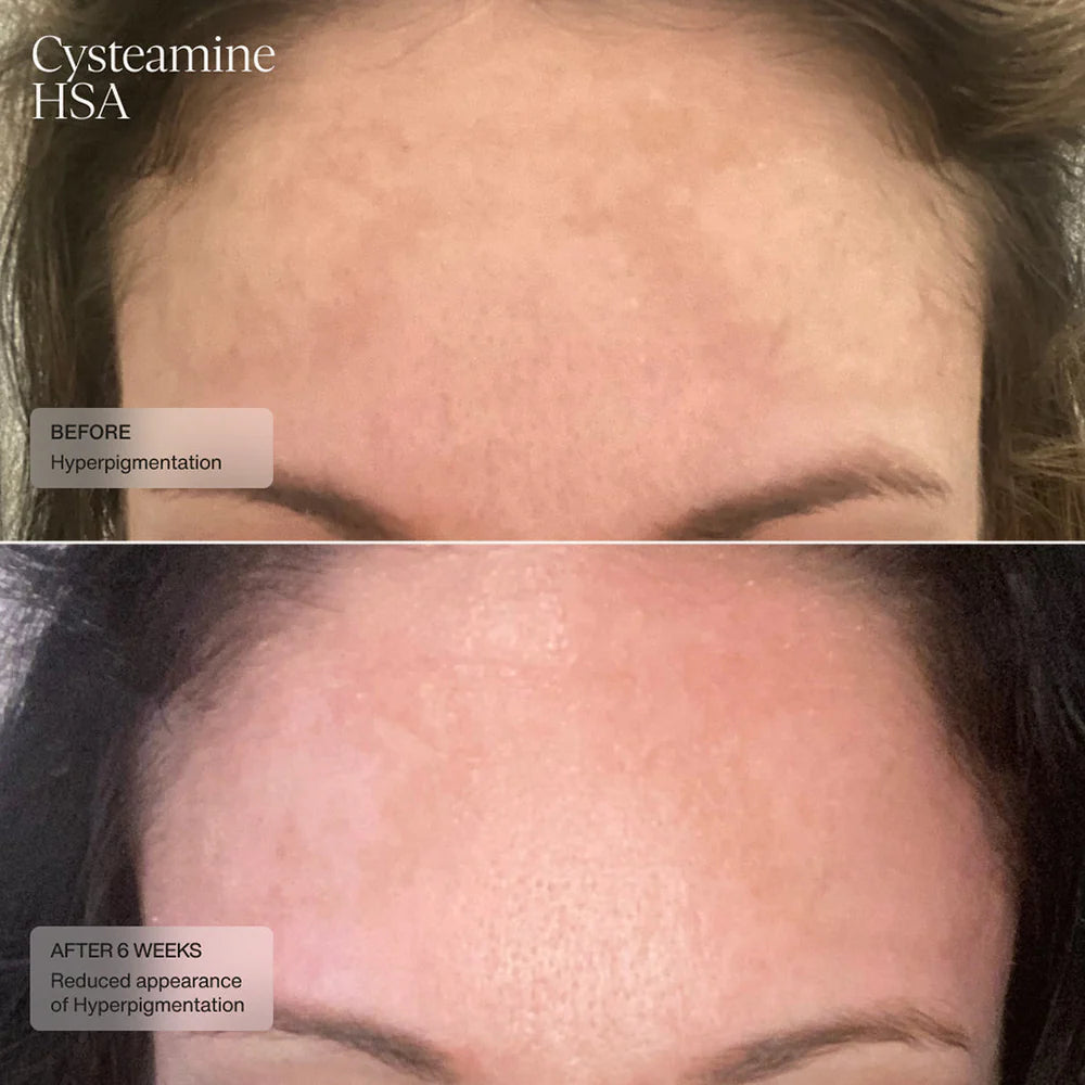 Senté® Limited Edition: Even Skin Tone Kit