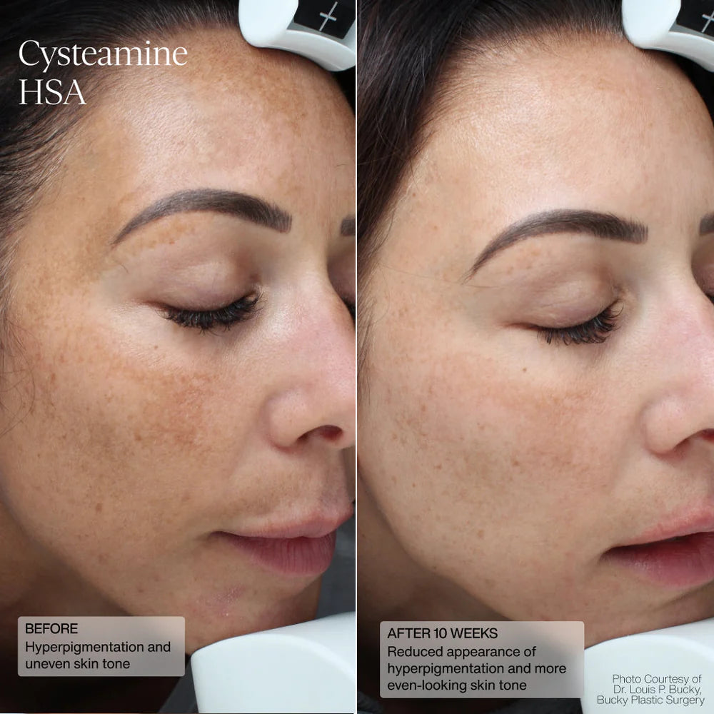 Senté® Limited Edition: Even Skin Tone Kit