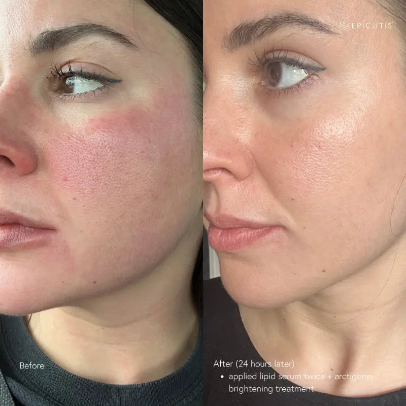 Epicutis Arctigenin Brightening Treatment 30ml