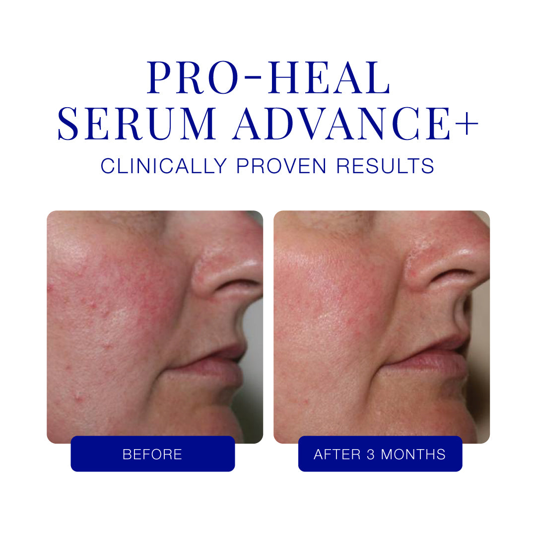 iS CLINICAL® Pro-Heal Serum Advance+