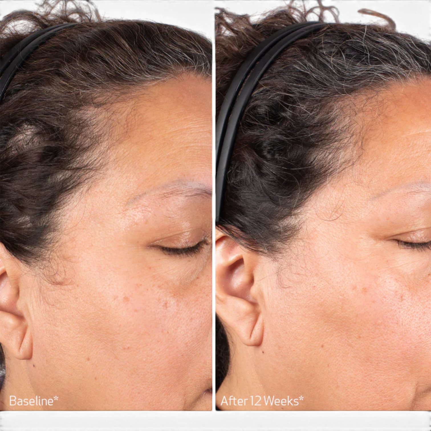 Obagi Nu-Cil BioStim Scalp Serum